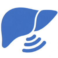 Fibroscan