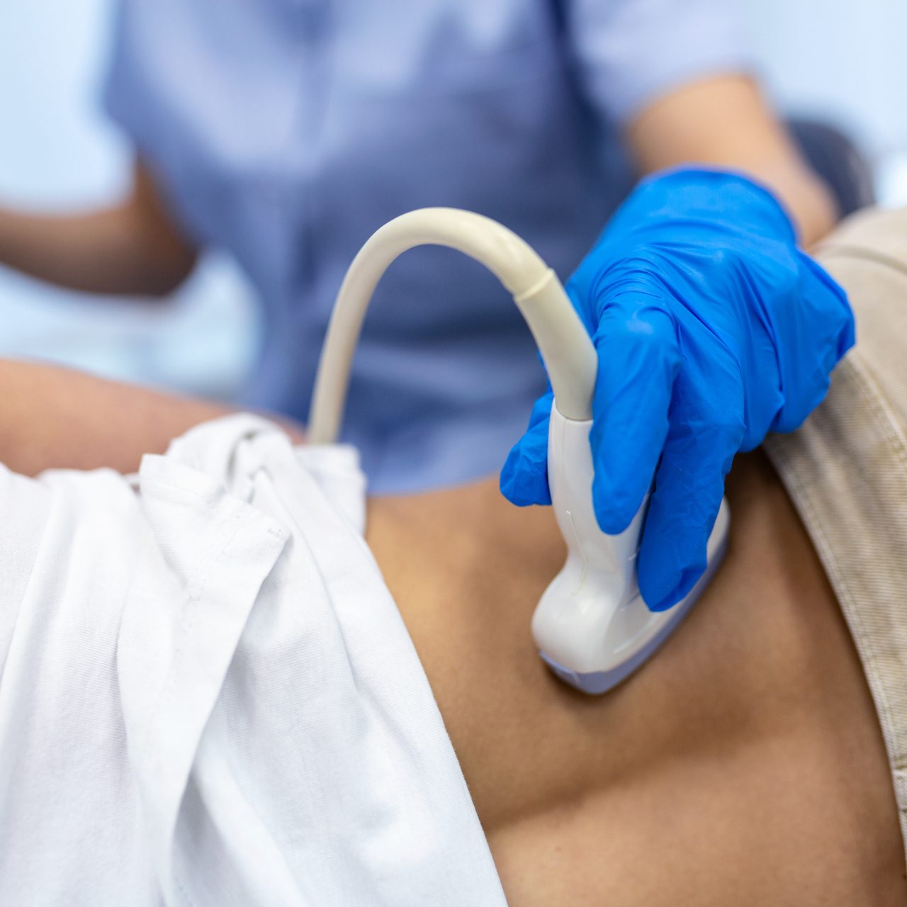 Fibroscan